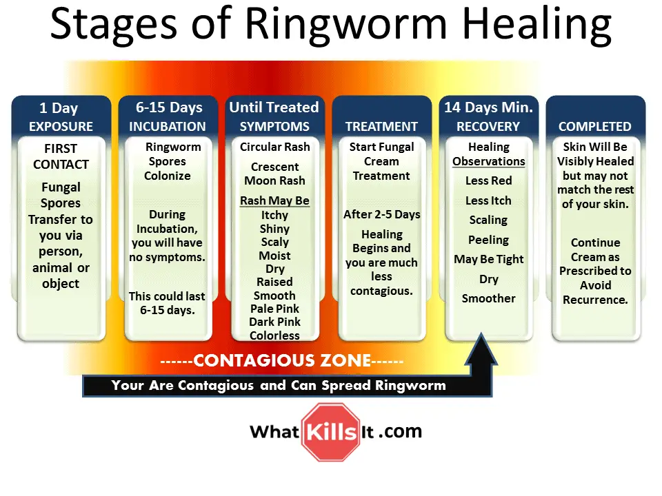 Chart and progression of ringworm healing stages.